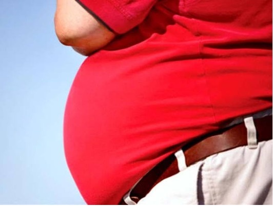 Understanding Obesity: Comprehensive Insights into Causes and Effective Management
